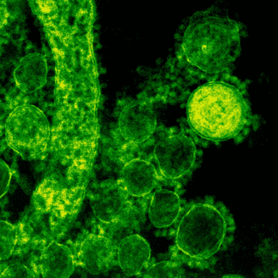 probiotic and prebiotic